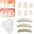 Temporary Tooth Repair kits for Filling The Missing Broken Tooth and Gaps-Moldable Fake Teeth and Thermal Beads Replacement Kits